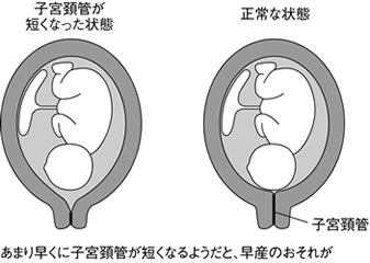 特集２ 妊娠かな と思ったら 早く受診して身を守ろう 全日本民医連