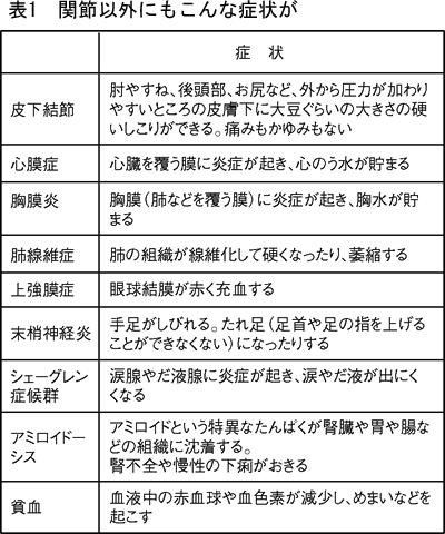 症状 体験 初期 談 リウマチ