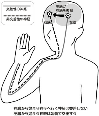 特集２ 脳科学とともに発展 脳梗塞のリハビリ 全日本民医連