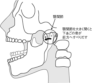 特集2 頭痛にご用心 上 あごの関節や目の痛みも原因に いつもと違う ときは要注意 全日本民医連