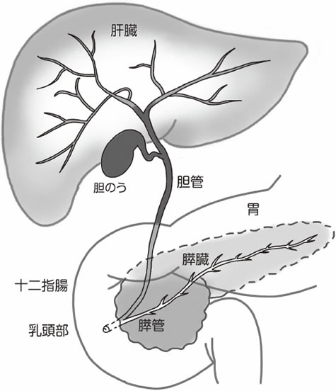 特集2 胆管がん 早期診断が難しく 治りにくい病気 全日本民医連