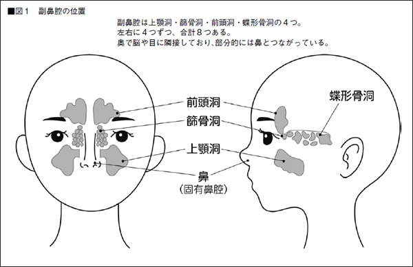 特集２ 副鼻腔炎 重大な合併症を引き起こすことも 全日本民医連