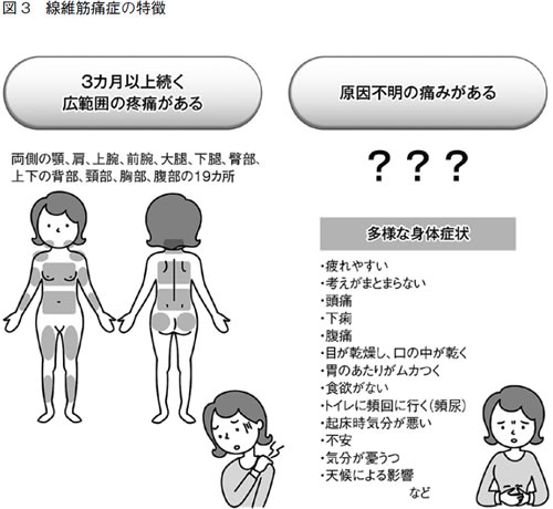 特集２ 線維筋痛症 原因不明の痛みと多様な症状をともなう 全日本民医連