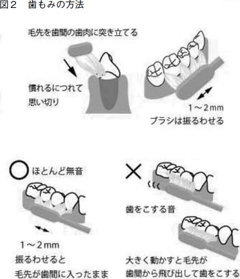 特集２ 歯周病 適切なセルフケアで予防できる 全日本民医連