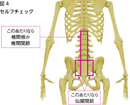 腰痛 尾てい骨 の 上